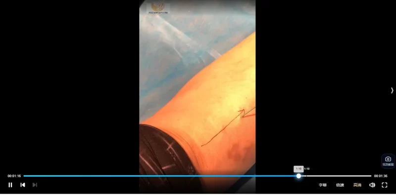 经典针刺手法大合集_易经玄学资料网